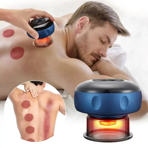 A blue and black heated cupping massage device being used on a man's upper back, with red circular marks showing massage points. The image includes a close-up of the device and an inset showing the back of a man's shoulder with cupping marks.